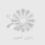 راهنمای کامل انتخاب سایبان مناسب | هر آنچه قبل از خرید سایبان باید بدانید